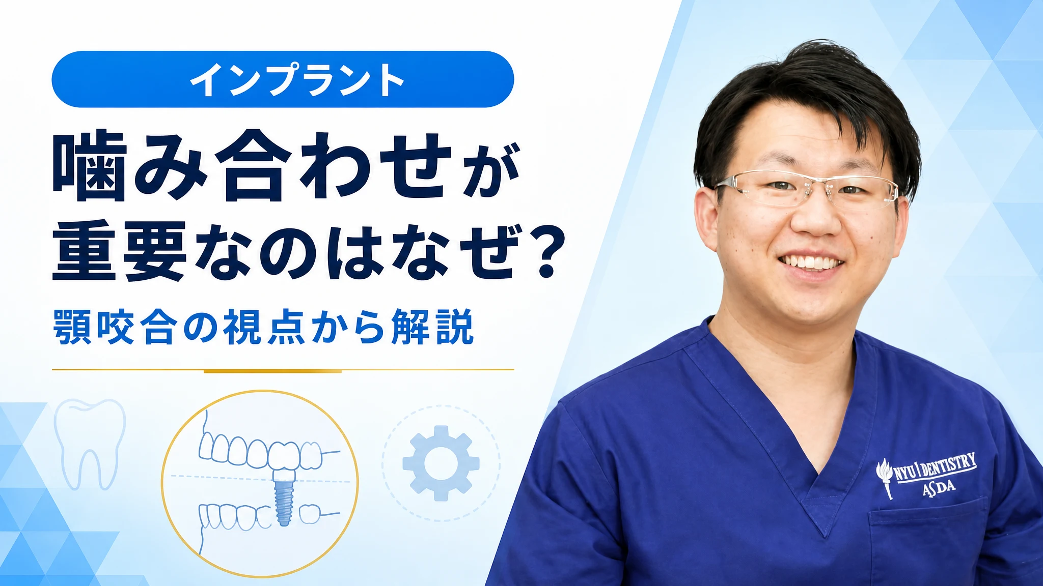 インプラントで噛み合わせが重要なのはなぜ?顎咬合の視点から解説